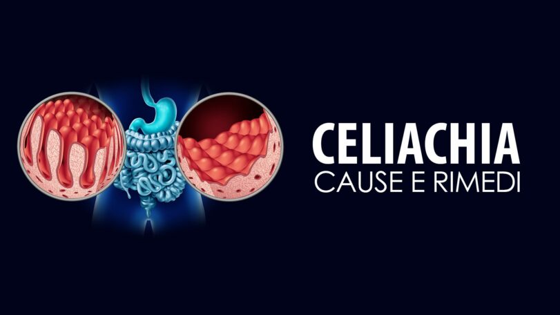 Celiachia: cause e rimedi