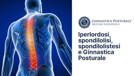 Iperlordosi, spondilolisi, spondilolistesi e Ginnastica Posturale